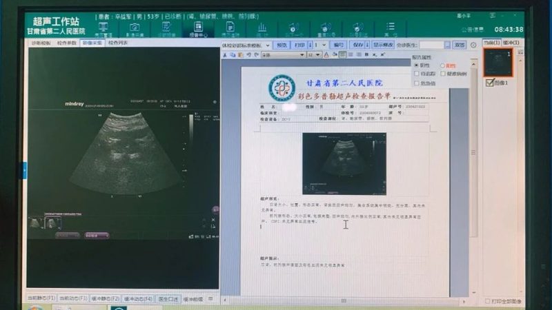 小标题：体检前的准备